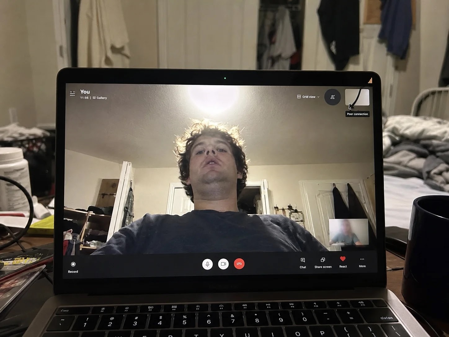 A poor video call setup with light behind the back
